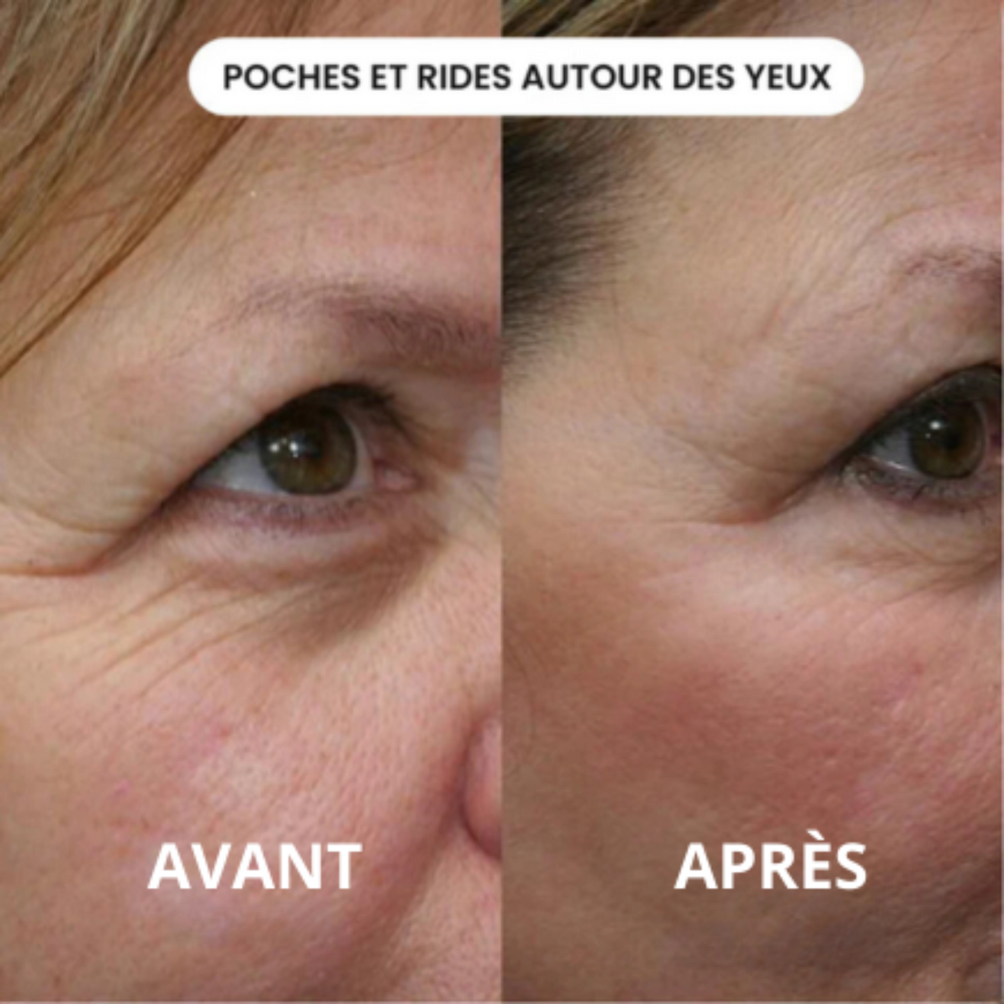 Infusion Active Cureline™