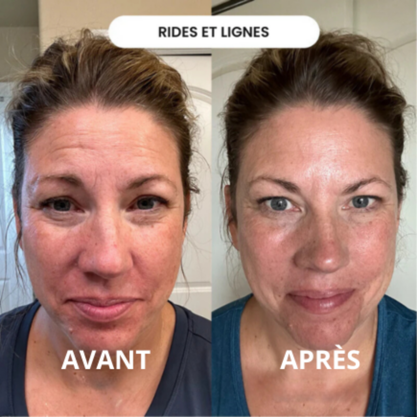 Infusion Active Cureline™