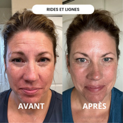 Infusion Active Cureline™